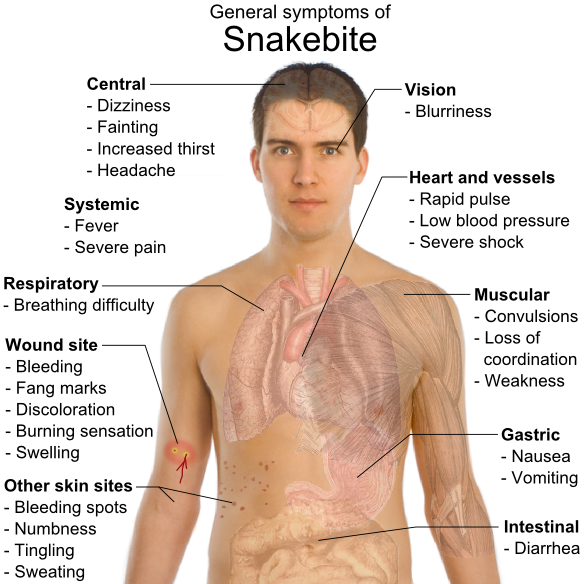 Snakebite_symptoms